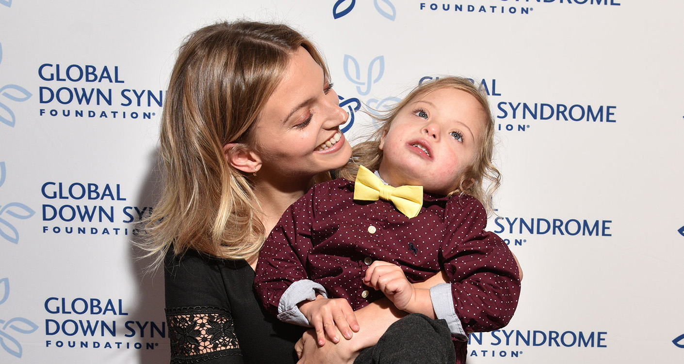 Child with Down Syndrome: Model Amanda Booth sends positive signal